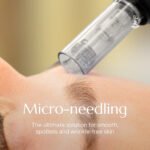 Microneedling with Skin Booster + 12-Hour Onsen Access in WP Kuala Lumpur